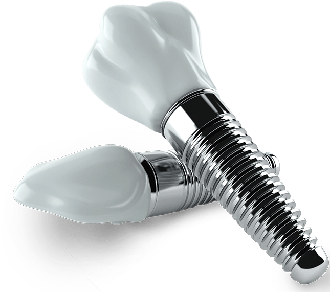 Dental implants